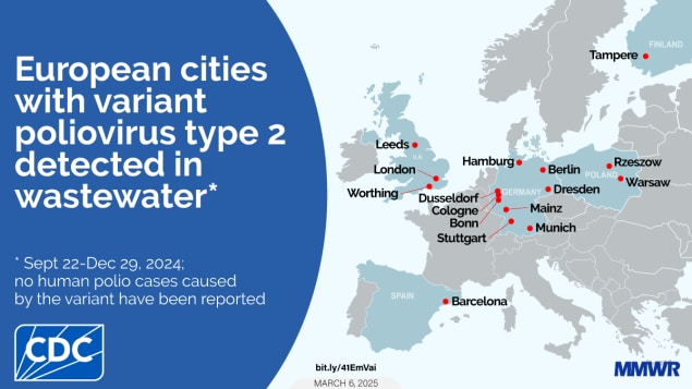 Notes from the Field: Detection of Vaccine-Derived Poliovirus Type 2 in Wastewater — Five European Countries, September–December 2024 The image shows a map of Europe with the several cities in the U.K., Germany, Poland, Finland, and Spain highlighted. Text reads, “European cities with variant poliovirus type 2 detected in wastewater.”