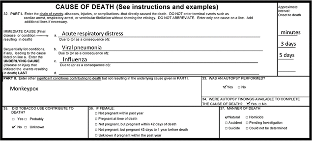 An example of how to write a death certificate related to monkeypox