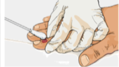 an illustration of a healthcare worker collecting an monkeypox specimen from a patient's finger