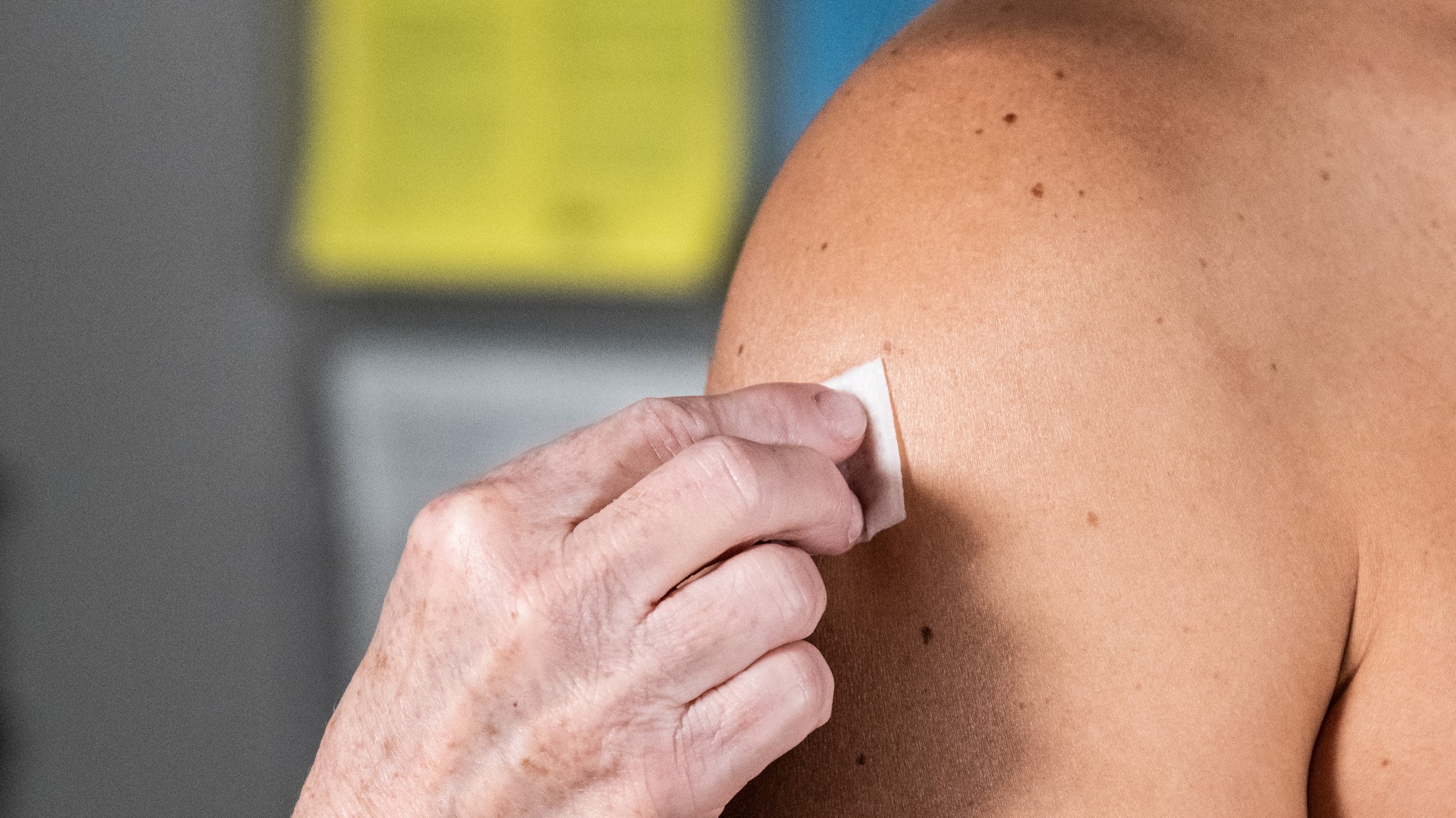 a healthcare provider cleans the skin on a patient's arm before a vaccineProveedor de atención médica limpiando la piel del brazo de un paciente antes de ponerle una vacuna