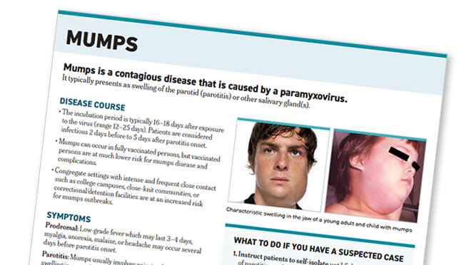 Mumps Clinical Diagnosis