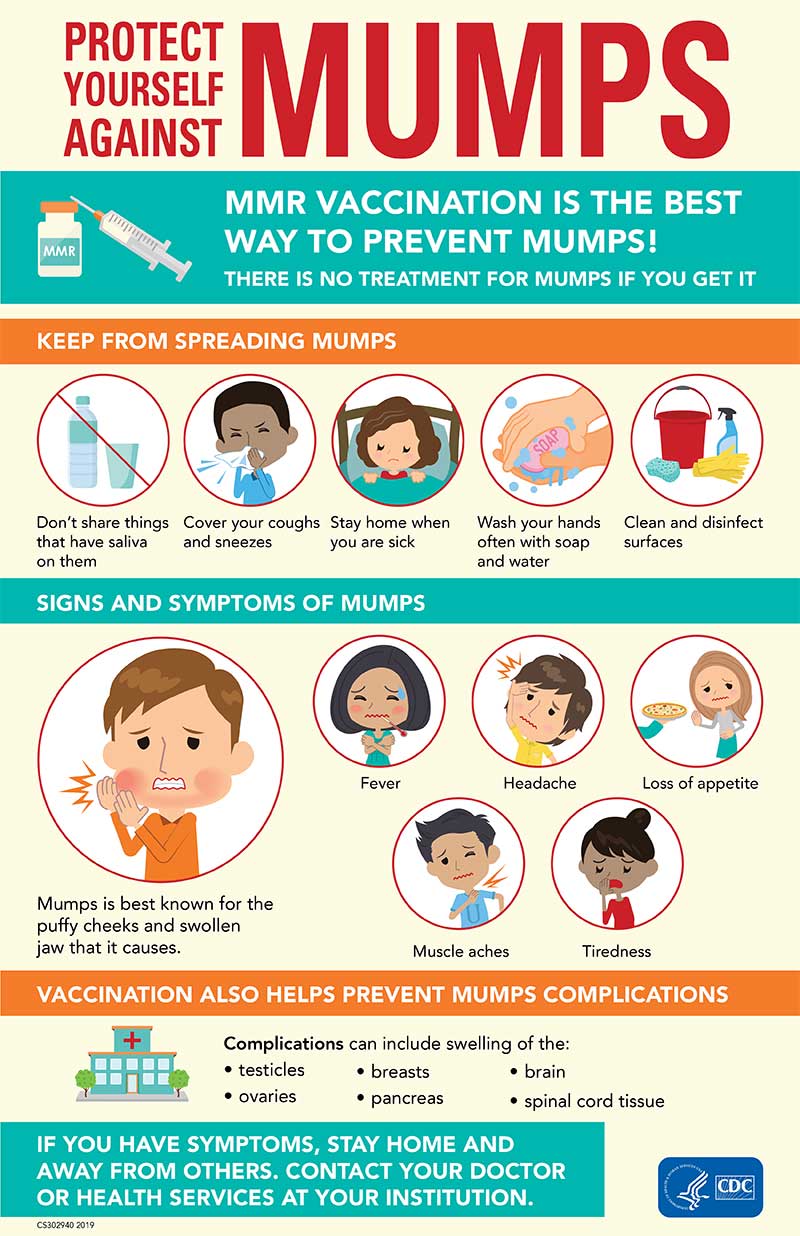 Mumps, Don't Let Mumps Spoil Your Fun Infographic