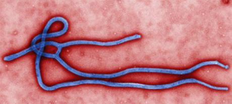 outofcollection01 Ebola microscopic image