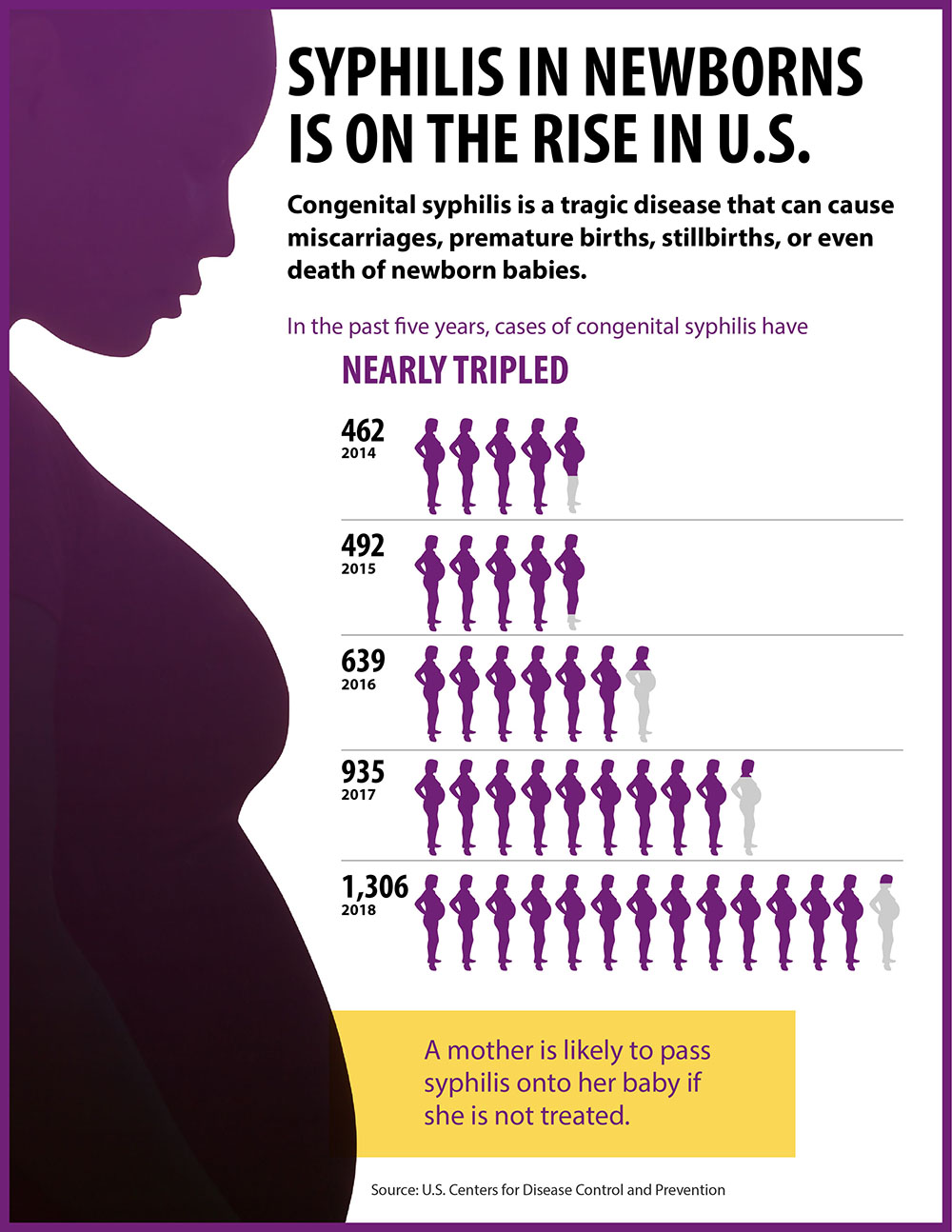 Unlimited CDC Syph FINALav infoGraphics Syphilis in newborns is on the rise in the US