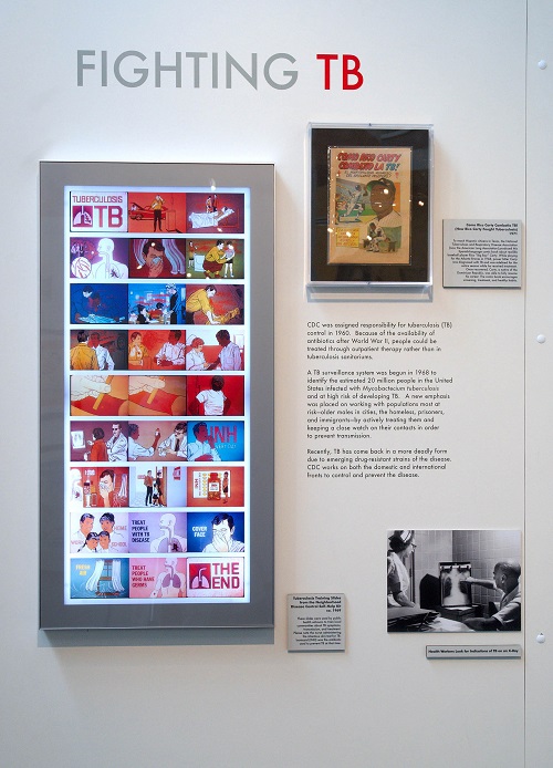 tb-installation TB installation