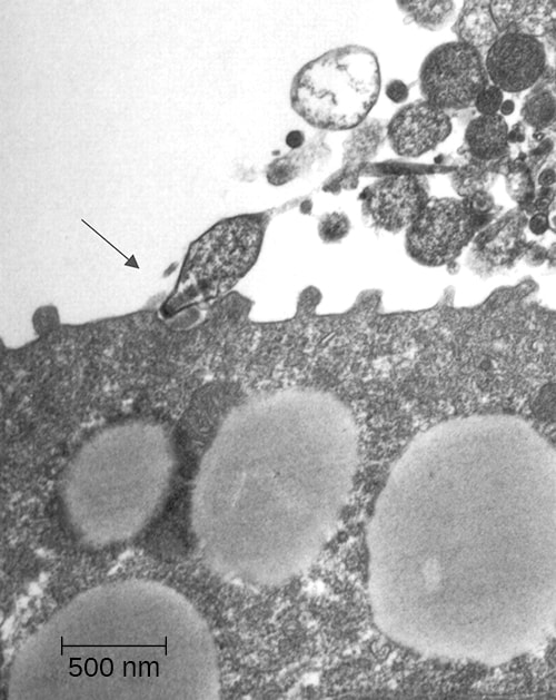 M. pneumoniae attaching to a host cell.