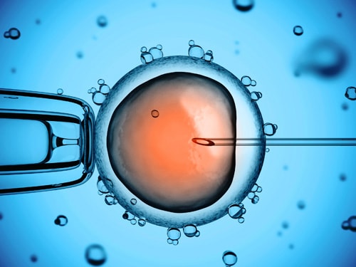 assisted reproductive technology case study