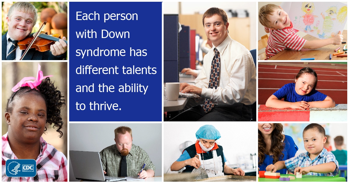 Facts About Down Syndrome Cdc