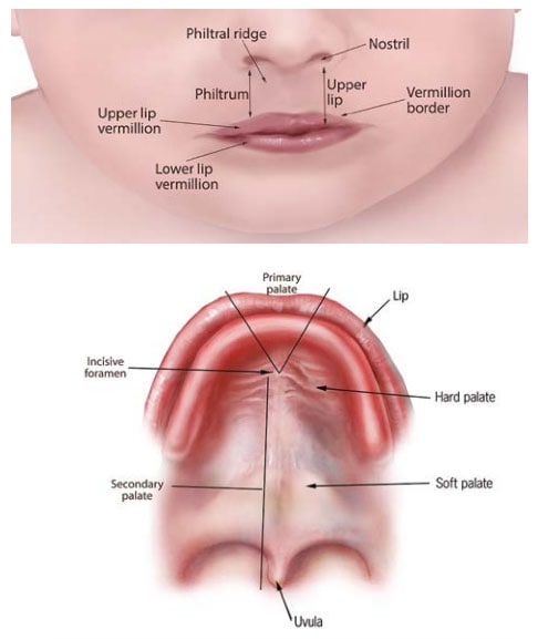 cleft lip and alveolus