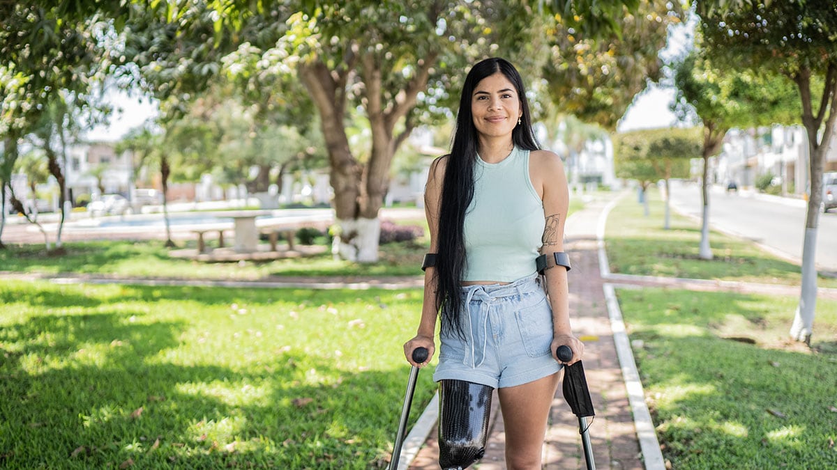 A woman with a prosthetic leg visiting a park