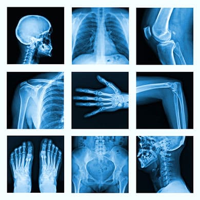 See The Difference? Before & After X-Rays Are Proof That What We
