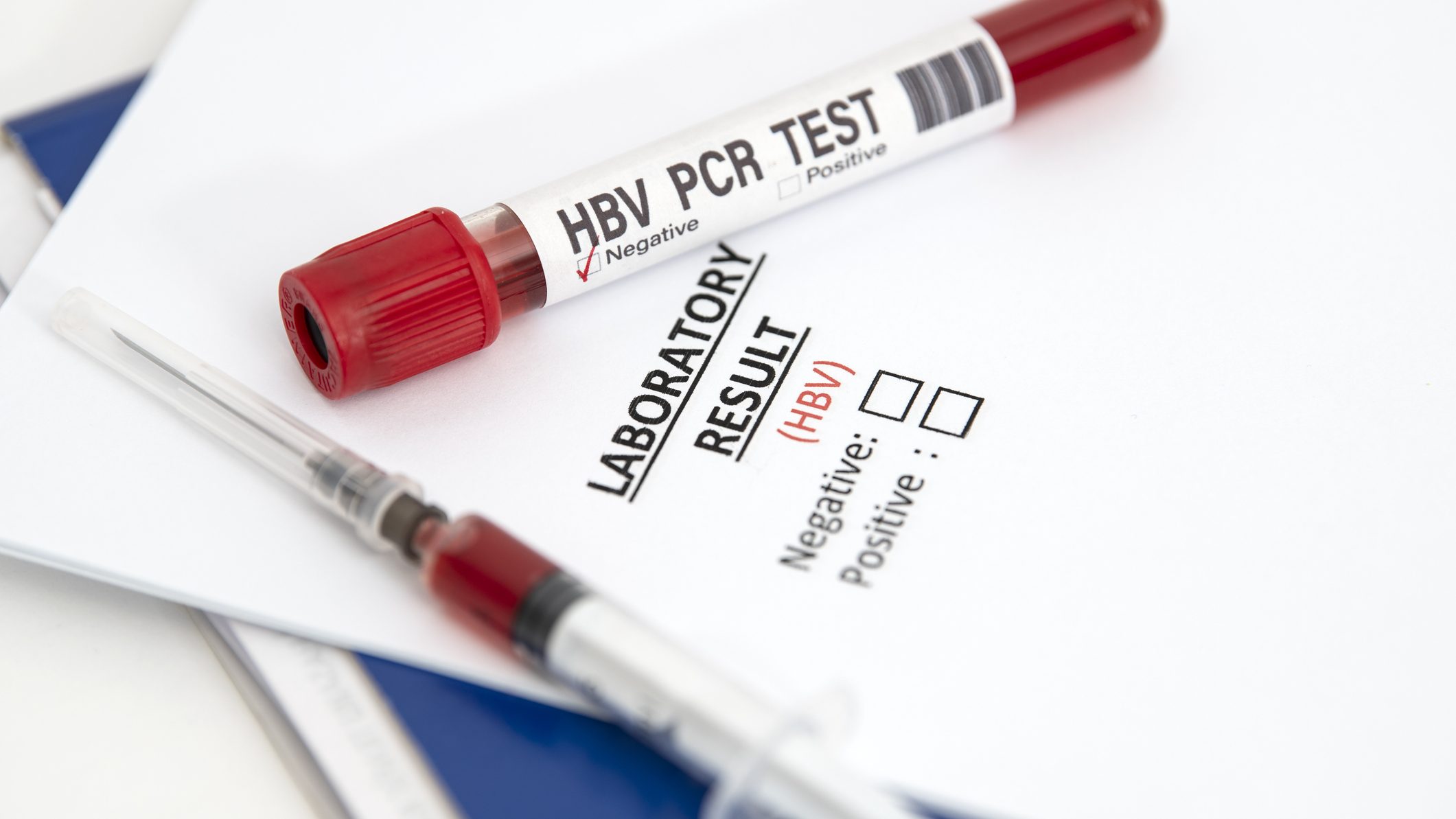 Hepatitis test is performed in the Laboratory