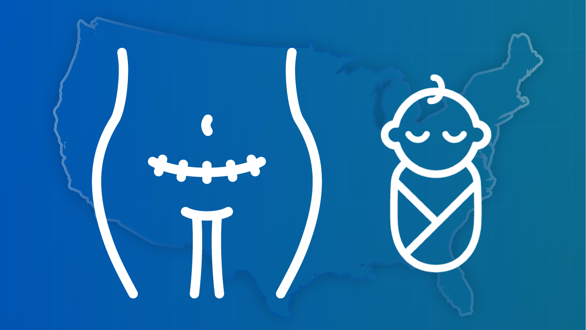 An outline of a woman's torso with a C-section scar and a baby next to her against a backdrop of a U.S. map.