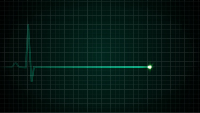 A medical monitor flat line representing death.