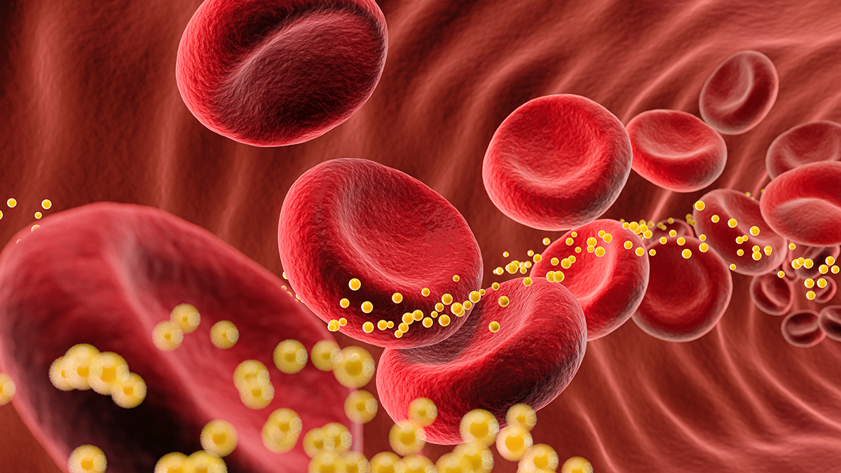 Illustration of red blood cells and cholesterol traveling through a blood vessel