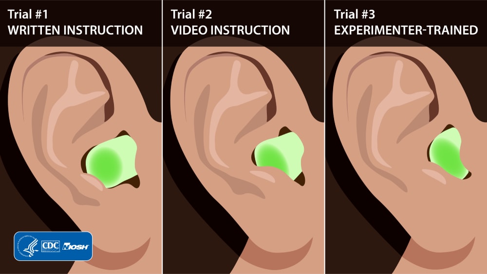 a series of three photos of ear plugs inside of ears, showing improved fits going from written instruction, video instruction, to experimenter trained instruction.