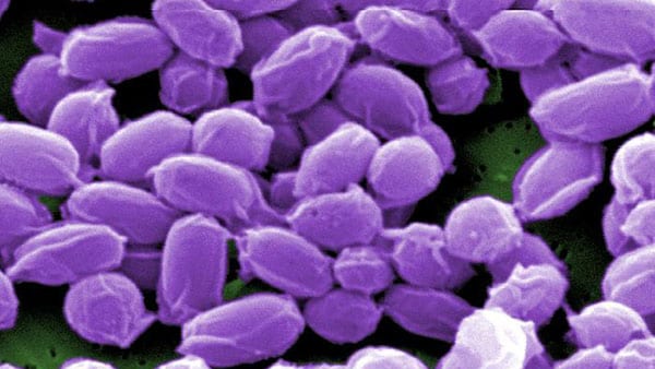 Microscopic image of anthrax