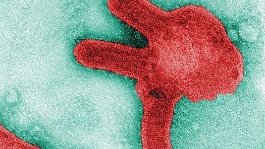 Microscopic image of Marburg Virus