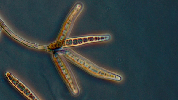 Microscopic image of meningitis