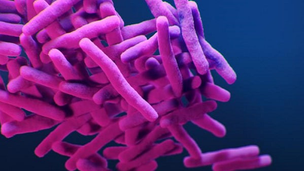Microscopic image of Tuberculosis
