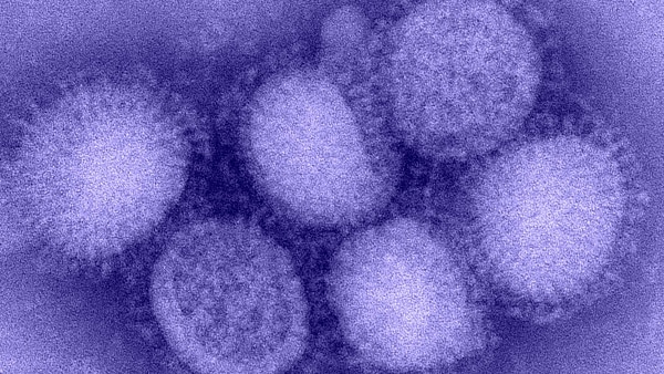 H5N1 Influenza Virus