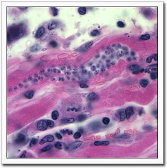 The amastigote form of T. cruzi in a hematoxylin and eosin stained slide of heart muscle tissue.