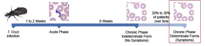 A time line of Chagas disease showing that it takes 1 - 2 weeks for a person to go through the incubation period before experiencing the Acute Phase of Chagas and then another 8 weeks before experiencing the Chronic Phase of Chagas disease.