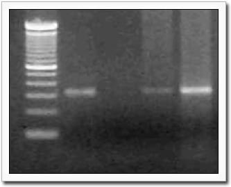 Gel electrophoresis showing T. cruzi DNA fragments by PCR from blood.