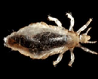 Head lice View Causes Symptoms and Treatments  1mg