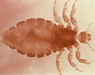 body louse and head louse Pediculus spp