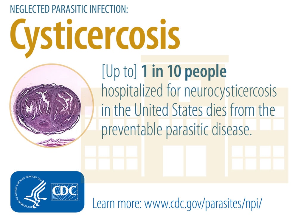 parasites in human stool symptoms