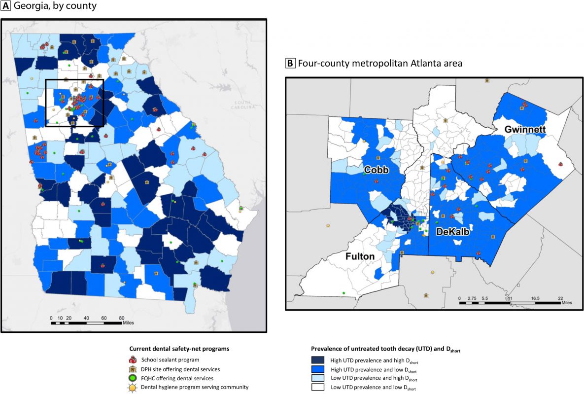 20_0488_01 Current dental safety-net programs and areas of need for children aged 6 to 9 years. A, In Georgia, by county. Inset indicates the metropolitan Atlanta area. B, Metropolitan Atlanta area, by census tract. Maps were created by a data visualization tool that can be used to evaluate allocation of dental safety-net programs across the state and to inform decision makers on future resource needs and allocation. Dshort represents the severity of a dental workforce shortage and is quantified as the number of full-time equivalent dental practitioners required to make the area a nonshortage area. Data sources: Lin et al (7), Health Resources and Services Administration (8), Georgia Department of Public Health (DPH) Oral Health Program (9), Georgia Primary Care Association (10), and Georgia Oral Health Coalition (11). Abbreviations: Dshort, shortage of dental practitioners; FQHC, federally qualified health center; UTD, untreated tooth decay.