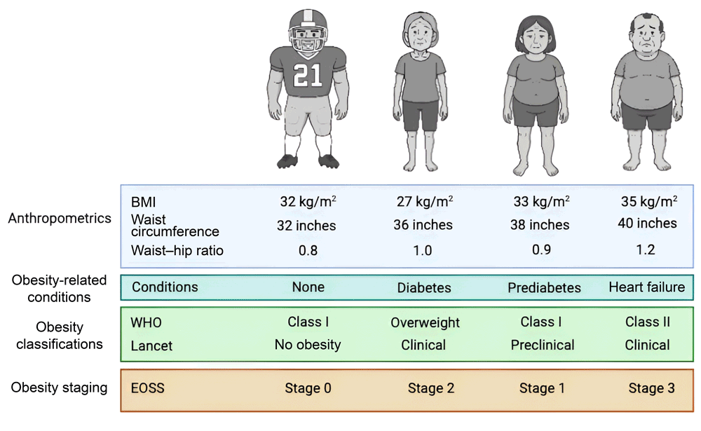 Four representative case examples of individuals characterized by obesity anthropometrics, related conditions, classifications, and staging.