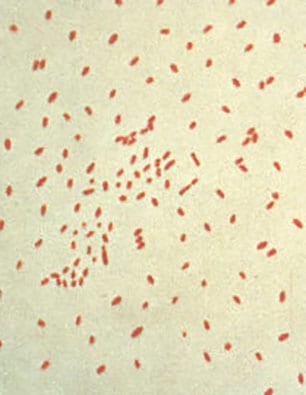 pertussis bacteria