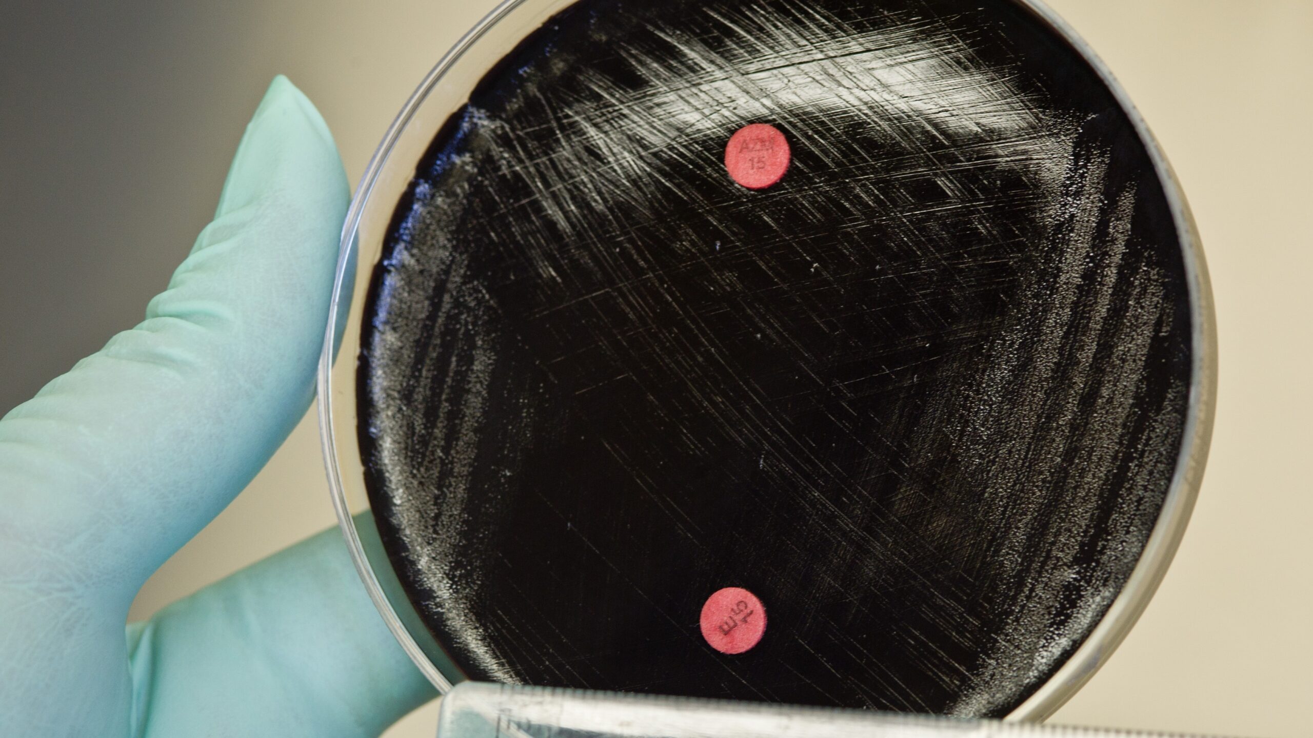 Macrolide-resistant Bordetella pertussis