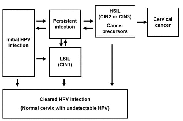 Chart showing the process by which HPV can develop into cervical cancer or result in a cleared HPV infection.