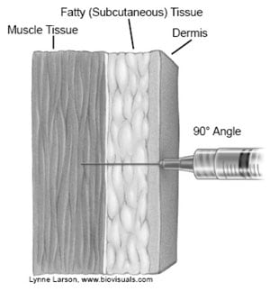 Illustration of injection through dermis and fatty tissue into muscle tissue at 90-degree angle.