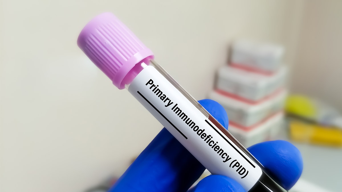 Biochemist holds blood sample for primary immunodeficiency (PI) test in laboratory.