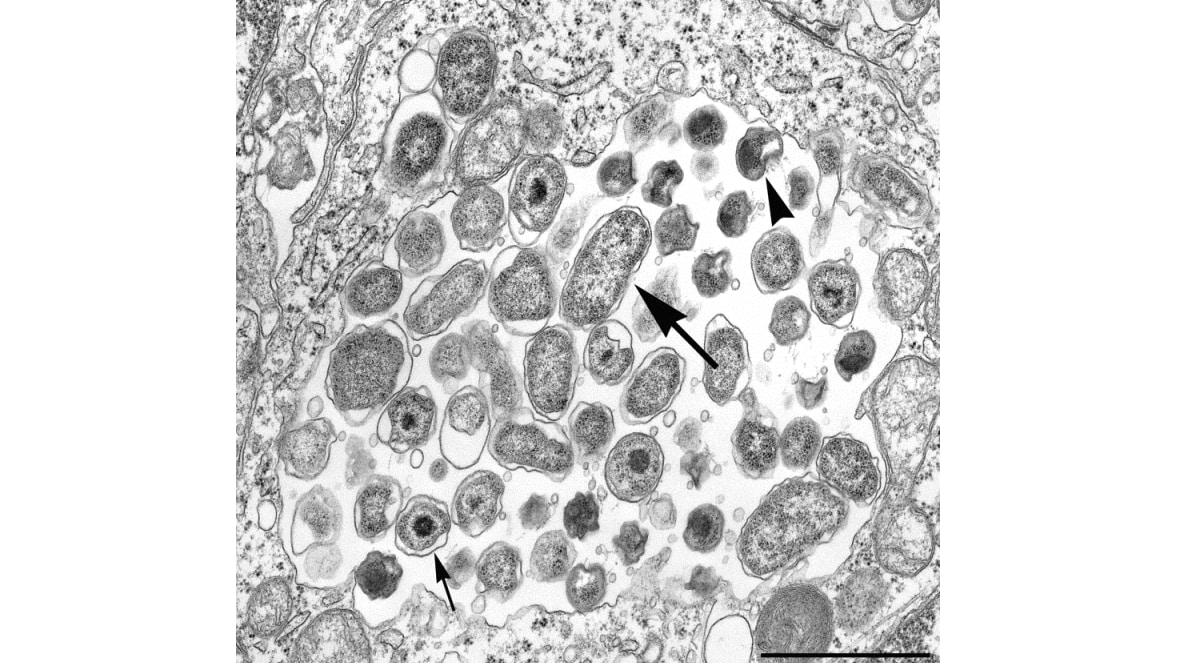 Electron micrograph of Chlamydia psittaci cells.