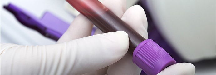 A clinician holding a blood sample.