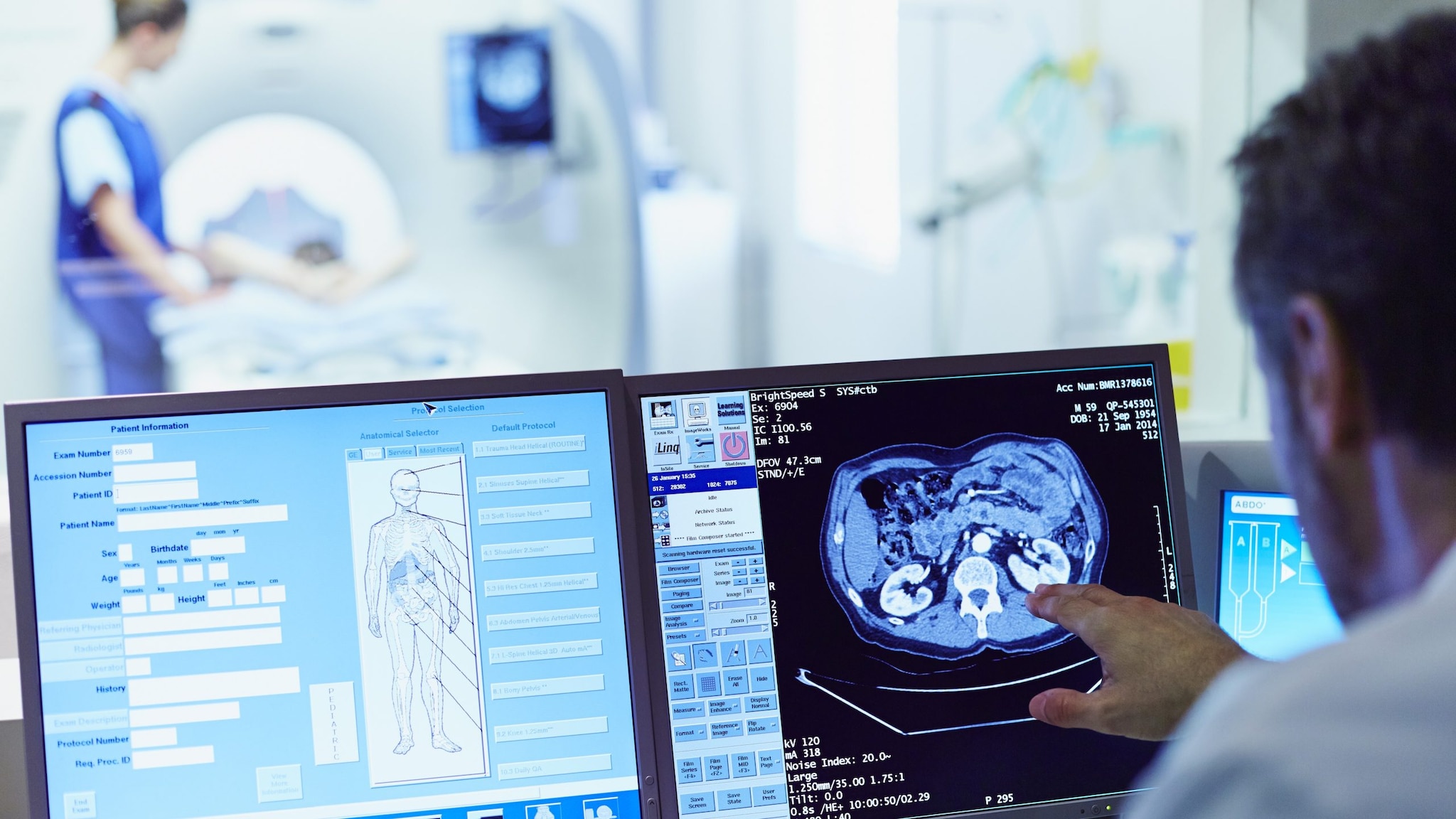 Un médico señala a una tomografía computarizada del cerebro en una pantalla de computadora