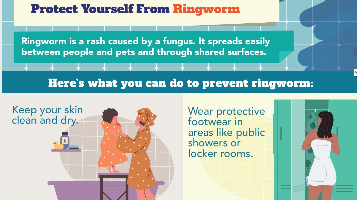 How to prevent ringworm