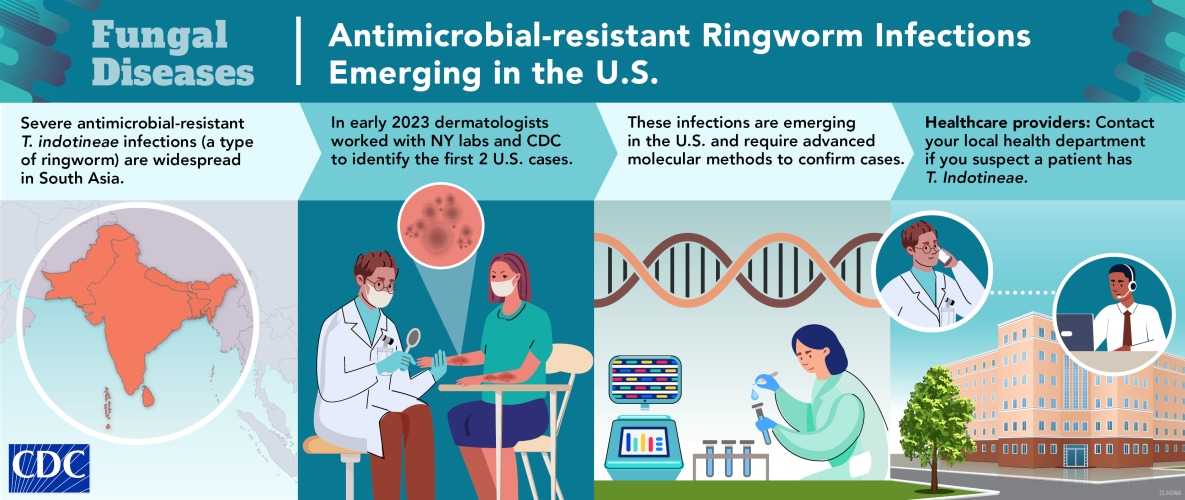 Cases of antimicrobial-resistant T. indotinea have been reported in the U.S..