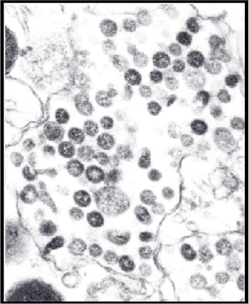 virus cell microscope