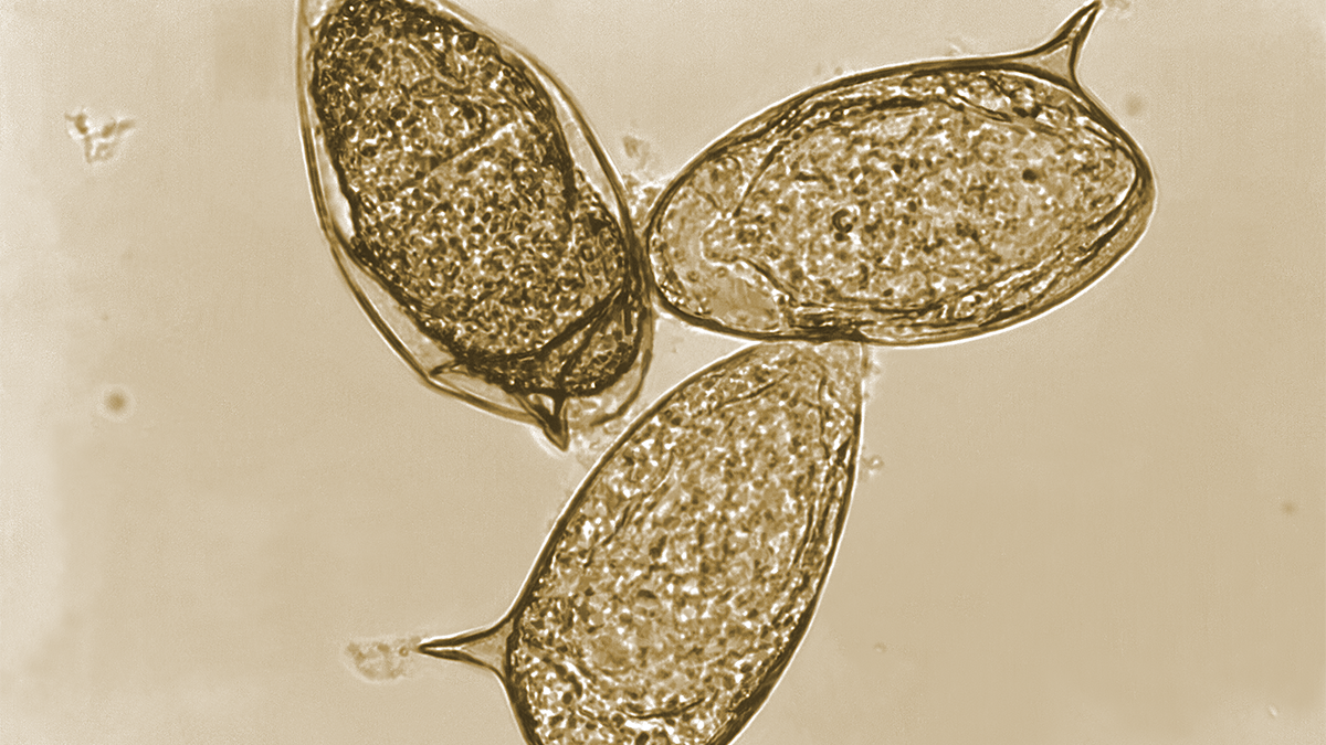 <em>Schistosoma mansoni</em> eggs