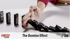 Sepsis is like a domino effect Thumb Image