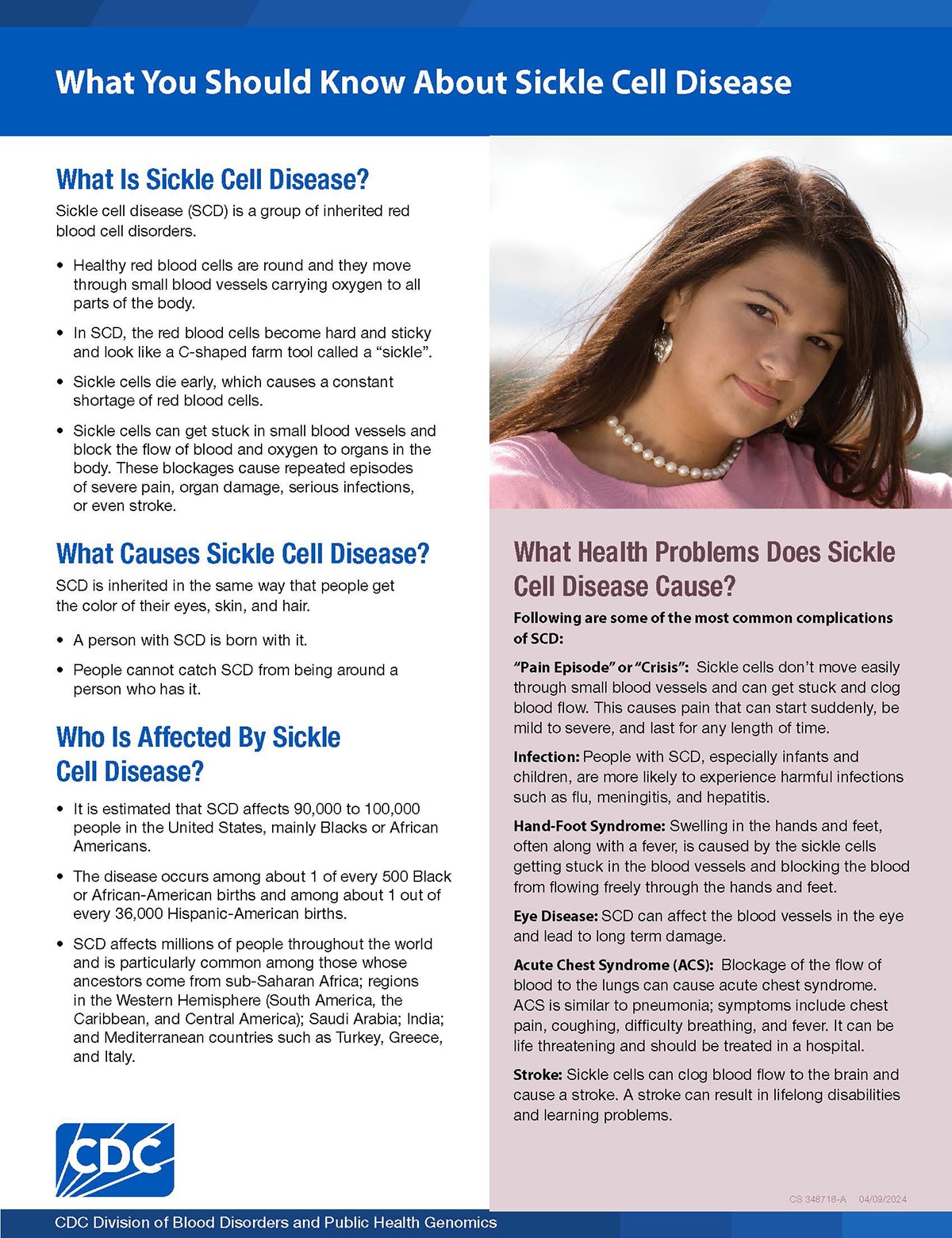 What You Should Know about Sickle Cell Disease fact sheet
