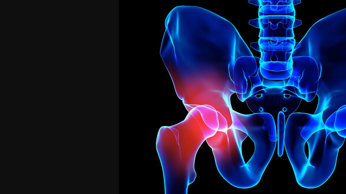 Hip pain, skeleton x-ray, 3D illustration.