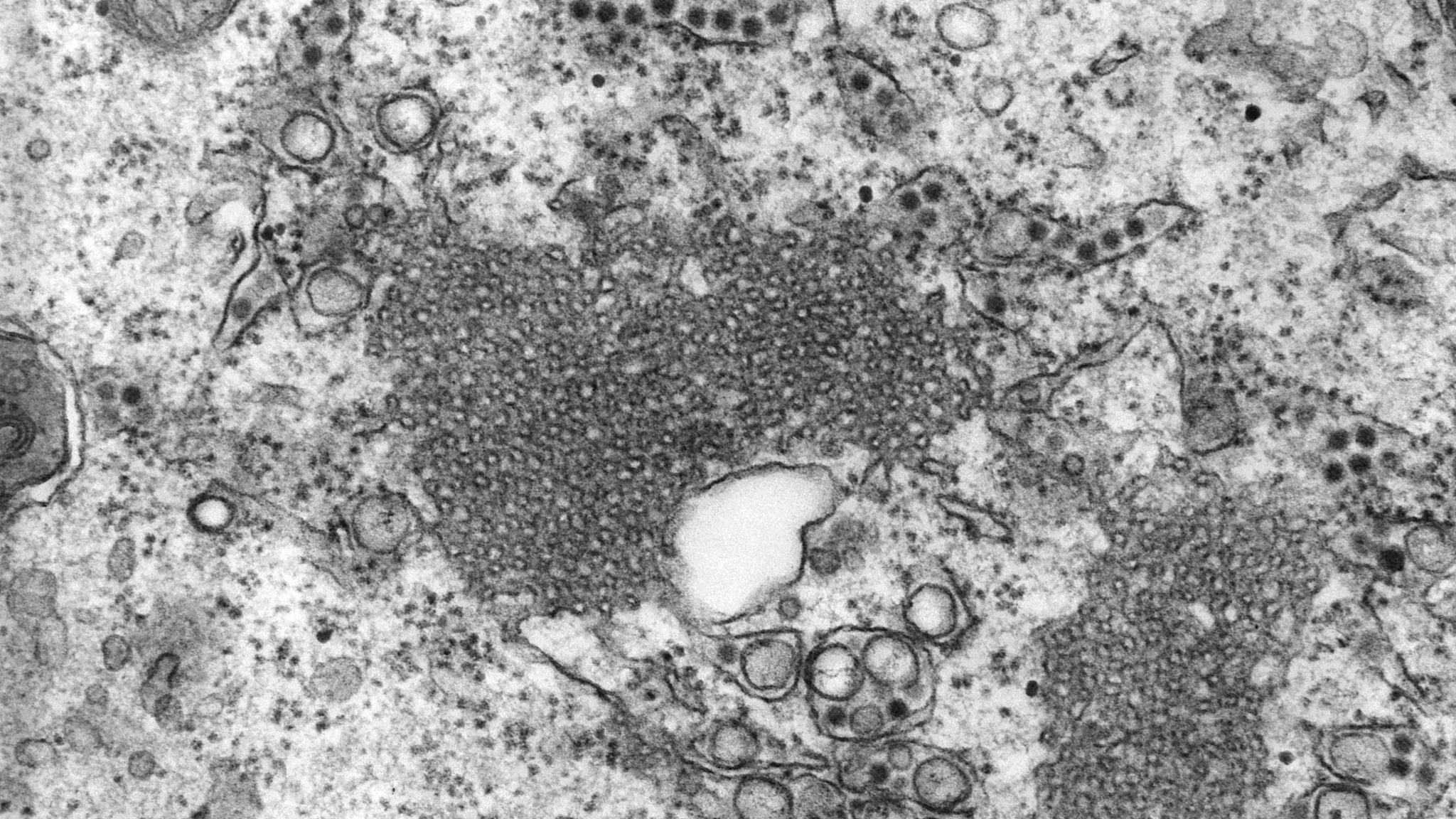 A transmission electron microscopic (TEM) image revealing the presence of St. Louis encephalitis virions.