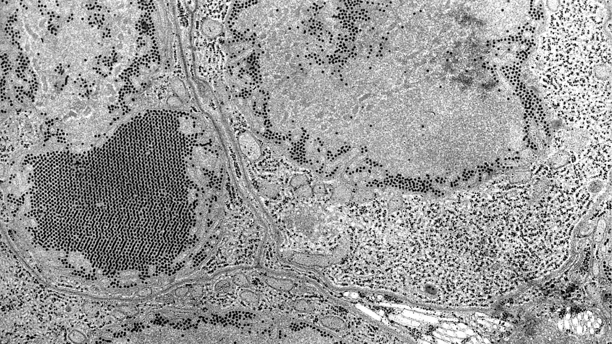 This transmission electron microscopic (TEM) image, revealed the presence of numerous St. Louis encephalitis (SLE) virions that were contained within a central nervous system tissue sample. SLE virus is a member of the genus Flavivirus, family Flaviviridae.